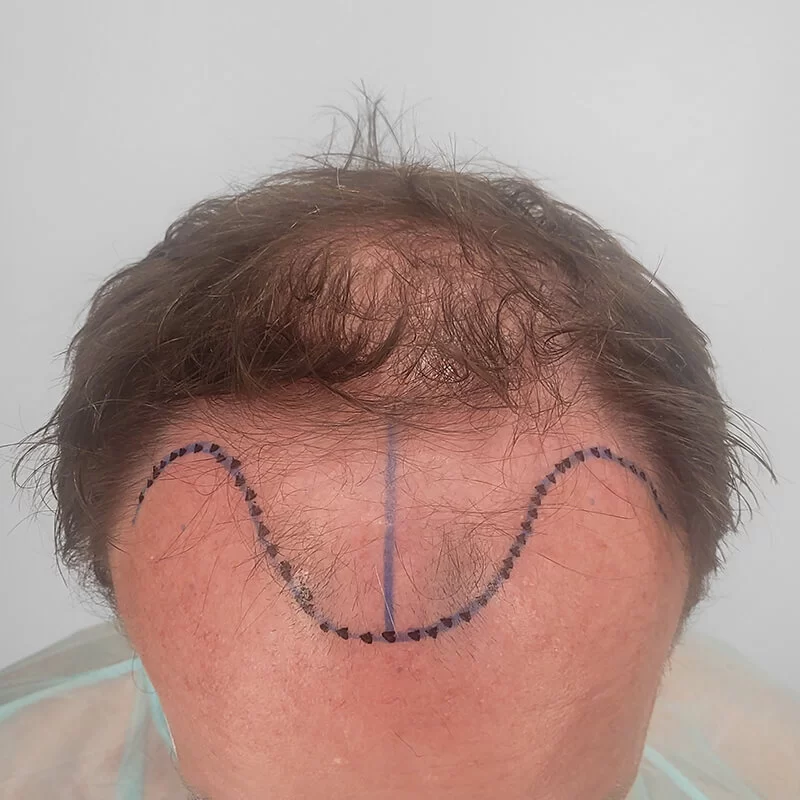 Antes