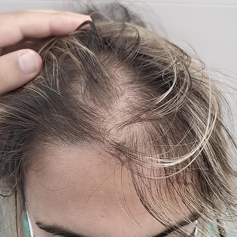 Antes